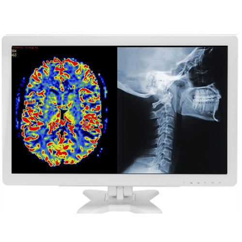 Медицинский монитор - MMS-27C-R10 - BriteMED Technology - хирургический / для эндоскопии / для лапароскопии