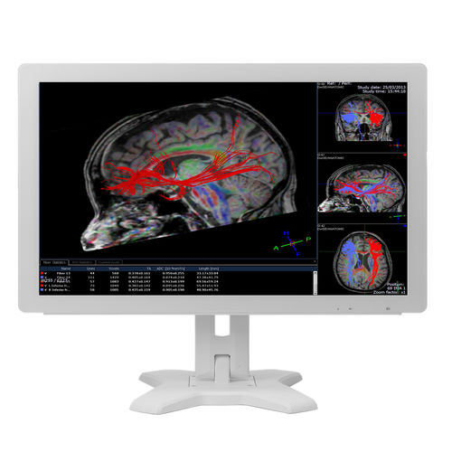 Медицинский монитор - MMS-21CAHST  - BriteMED Technology - для медицинских снимков / для медицинской симуляции / Full HD