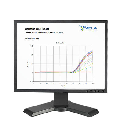 Программное обеспечение для анализа - Sentosa SA - Vela Diagnostics - для интерпретации / для молекулярной биологии
