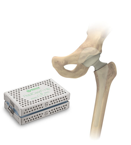Временная прокладка для бедра - RepliCase™ - US Orthopedics