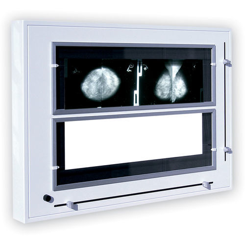 Негатоскоп 2 диапазона - Rego X-ray - с белым светом / для маммографии