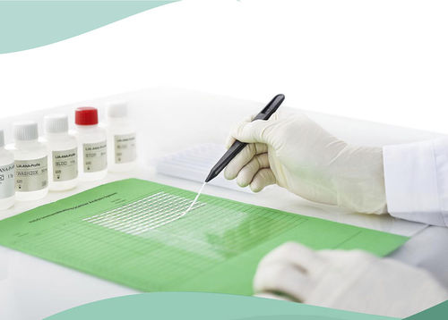 Тест-полоска на аутоиммунные заболевания - Shenzhen Yhlo Biotech Co., Ltd. - для болезней печени / для диабета / на васкулит