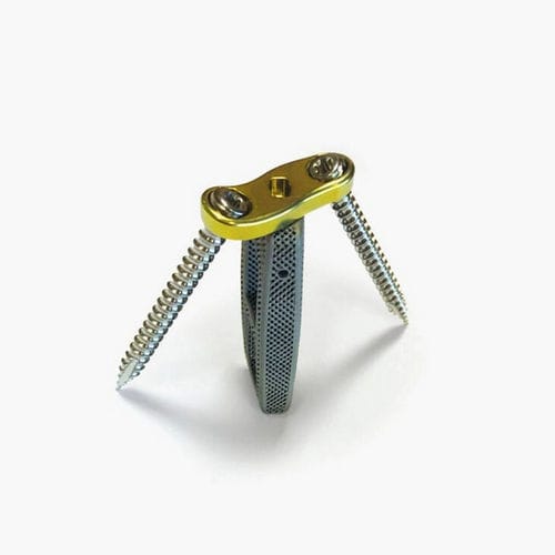 Межтеловой кейдж для поясничной зоны - Idys®-LLIF 3DTi - Clariance - боковой доступ / из титана / с костной пластиной поясничного отдела