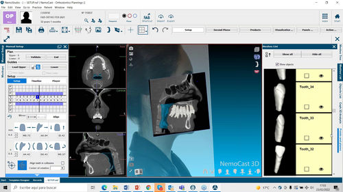 Медицинское программное обеспечение - NemoFab Ortho - Nemotec - клиническое / для стоматологии / для предоперационного планирования