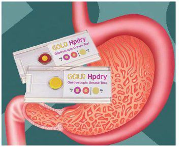 Набор для теста на инфекционные заболевания - Gold hpdry - Creo Medical - на уреазу / бактерия Helicobacter pylori / для биологических проб