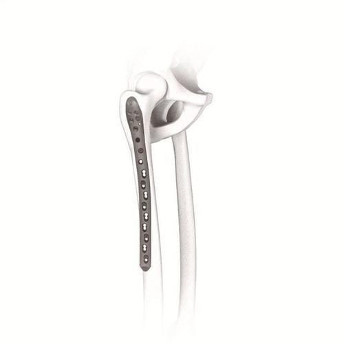 Компрессионная костная пластина бедренная кость - 123228 series - Canwell Medical - проксимальная / блокируемая / из титана