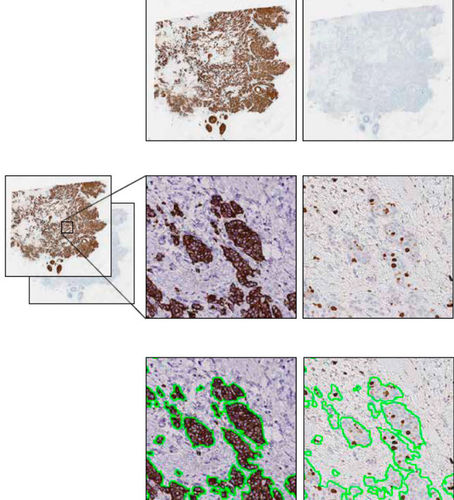 Клинический модуль программного обеспечения - VirtualDoubleStaining™  - Visiopharm - для лаборатории гистопатологии / для анализа изображений / для диагностики