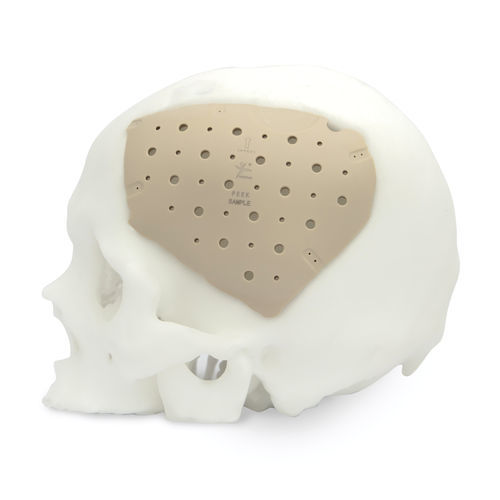 Черепной имплантат на заказ - CranioPEEK3D ™ - Kontour Medical Technology