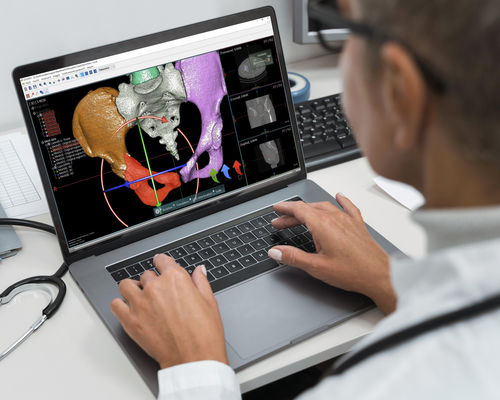 Программное обеспечение для предоперационного планирования - OOOPDS - Taiwan Main Orthopaedic Biotechnology - для визуализации / для симуляции / для печати 3D