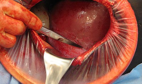 Симулятор пациента для родов - C-Celia C-SECTION - Operative Experience Inc. - для неотложной медицинской помощи / для хирургии / акушерский/гинекологический