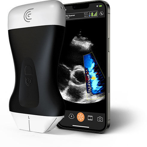 Портативный ультразвуковой сканер - PAL - Clarius Mobile Health - для поливалентной эхографии / цветовой допплер / черно-белый