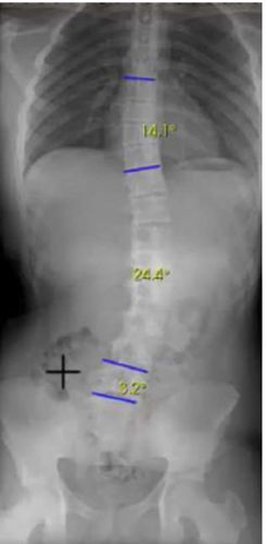 Программное обеспечение рентгенографии - Stitching solution for column and lower limbs - Medecom - для медицинского кабинета / для рентгенологии / для измерений