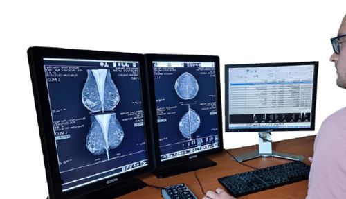 Программное обеспечение для диагностики - MED MAMMO - Medecom - медицинское / для системы архивации и передачи изображений / для маммографии