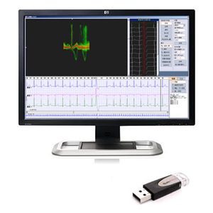 Программное обеспечение для составления отчетности - iTengo+  - BORSAM Biomedical Instrument - для анализа / для ЭКГ / для больниц