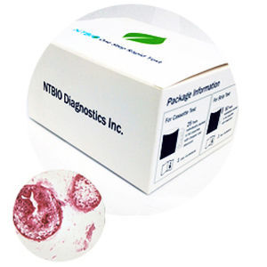 Экспресс-тест на FOB - N040 series - NTBIO Diagnostics - на раковые опухоли / для онкологии / на опухолевые маркеры