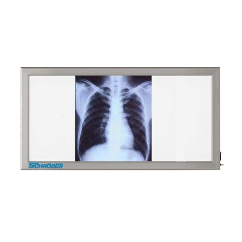 Негатоскоп 3 диапазона - NT 130 - SCHRODER HEALTH PROJECTS - с белым светом