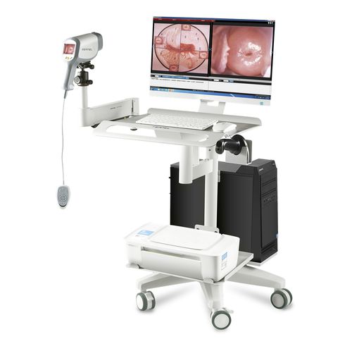 Видеокольпоскоп - KN-2200I - Kernel Medical Equipment Co., Ltd - на тележке