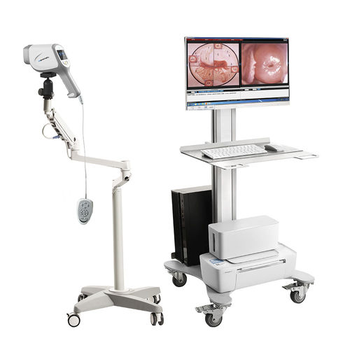 Видеокольпоскоп - KN-2200A - Kernel Medical Equipment Co., Ltd - на тележке