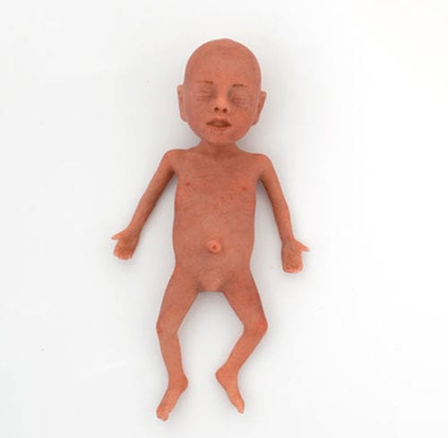 Учебный манекен для педиатрии - NENASim Preemie - MEDICAL-X - для реанимации / неонатальный
