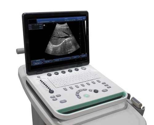 Ультразвуковой сканер переносной, с тележкой - DP-50  - Promed Technology - для эхографии в акушерстве и гинекологии / для брюшной и тазовой эхографии / для урологической эхографии