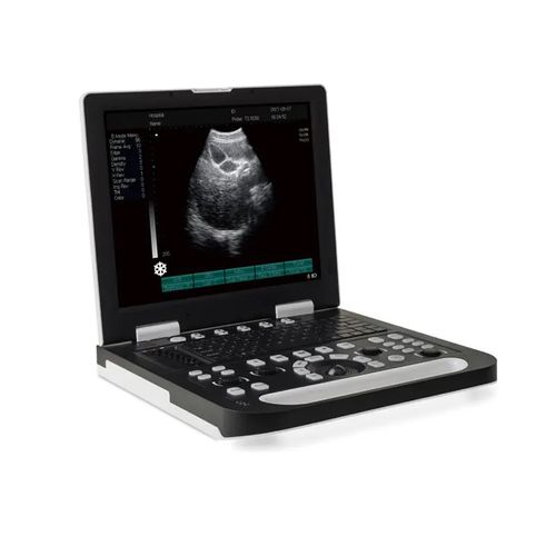 Переносной ультразвуковой сканер - DP-50 Plus - Promed Technology - для поливалентной эхографии / для эхографии в акушерстве и гинекологии / для брюшной и тазовой эхографии