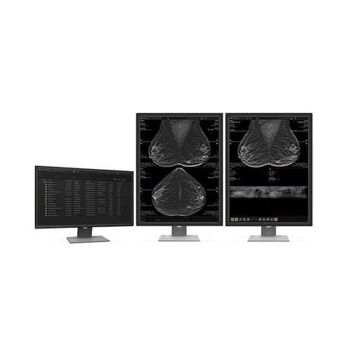 Медицинское программное обеспечение - MammoScape™ - VAREX Imaging - TDM / рентгенографии / для маммографии