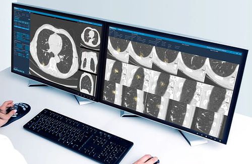 Медицинское программное обеспечение - Veolity - VAREX Imaging - рентгенографии / для анализа изображений / для управления