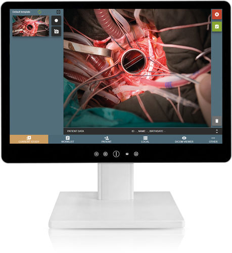 Видеорегистратор для эндоскопии - MEDDREAM VideoStation - MEDDREAM - для диагностики / хирургический / для медицинской симуляции