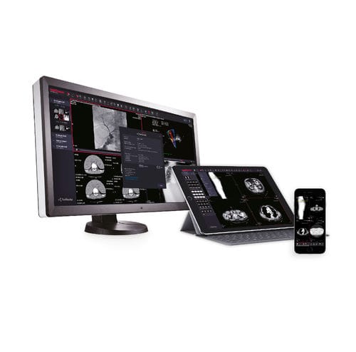 Программное обеспечение для визуализации DICOM - MedDream DICOM Viewer - MEDDREAM - для диагностики / для разработки / для непрерывной передачи