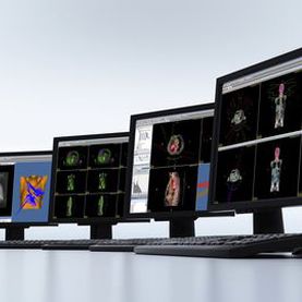 Программное обеспечение для визуализации - DICOM RT Studio - PTW Freiburg Physikalisch-Technische-Werkstätten - для обработки / для радиационной терапии