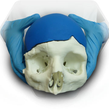 Черепной имплантат на заказ - SkullPT  - 3D Side