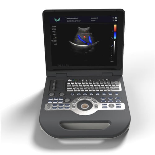 Переносной ультразвуковой сканер - XF3500 - Xianfeng Ultrasound Medical - для поливалентной эхографии / черно-белый / цветовой допплер