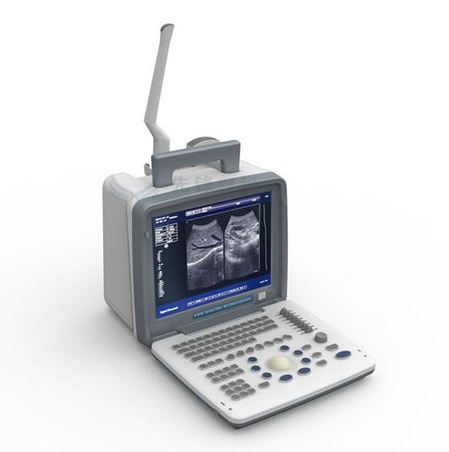 Переносной ультразвуковой сканер - XF300 - Xianfeng Ultrasound Medical - для поливалентной эхографии / черно-белый / со встроенной консолью