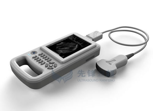 Портативный ультразвуковой сканер - XF20 - Xianfeng Ultrasound Medical - для поливалентной эхографии / черно-белый