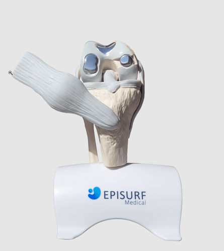 Имплантат для колена - Episurf Medical - анатомический / из кольбат-хрома