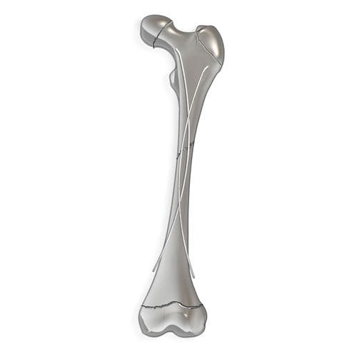 Интрамедуллярный штифт бедренная кость - pediFlex™ - OrthoPediatrics - большеберцовая кость / малоберцовая кость / плечевая кость