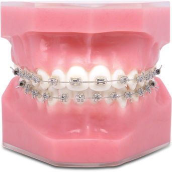 Ортодонтическая нить из сплава никеля и титана - TP Orthodontics - из нержавеющей стали / из титана