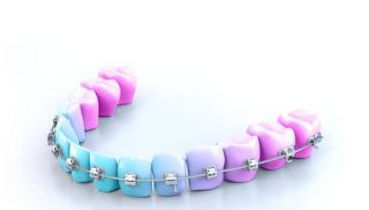 Ортодонтическая нить NiTi - BIO ACTIVE LIGHT - GC Orthodontics