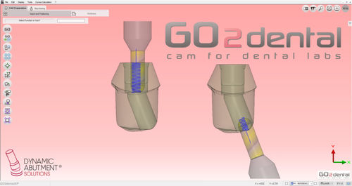 Программное обеспечение для стоматологических лабoраторий - GO2dental - Dynamic Abutment Solutions - FAO