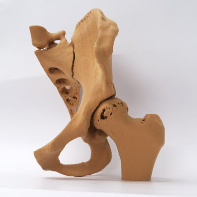 Анатомическая модель кости - 3D Lifeprints UK Ltd - таз / для бедра / учебная
