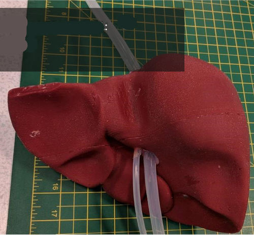 Анатомическая модель печени - 3D Lifeprints UK Ltd - для роботизированной хирургии / учебная