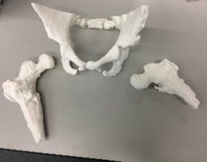 Анатомическая модель кости - 3D Lifeprints UK Ltd - таз / бедренной кости / для хирургии