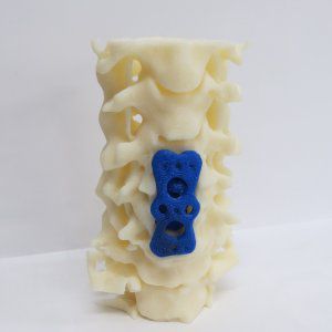 Анатомическая модель поясничный отдел позвоночника - 3D Lifeprints UK Ltd - для хирургии позвоночника
