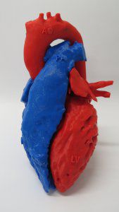 Анатомическая модель сердца - 3D Lifeprints UK Ltd - для кардиологической хирургии