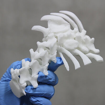 Анатомическая модель позвоночник - 3D Lifeprints UK Ltd - для сколиоза
