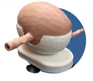 Анатомическая модель мочевого пузыря - 3D Lifeprints UK Ltd - для эндоскопии