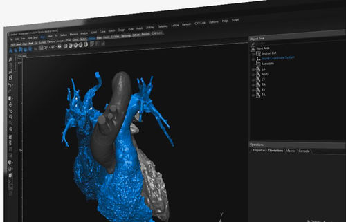 Программное обеспечение для визуализации 3D - 3-matic  - Materialise UK - медицинское / анатомическое / для разработки