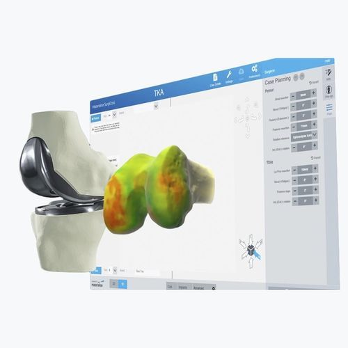 Программное обеспечение для визуализации 3D - Materialise UK - для планирования / хирургическое / предоперационное