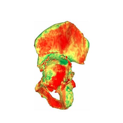 Медицинское программное обеспечение - aMace - Materialise UK - клиническое / TDM / для хирургии