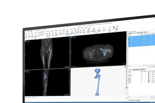 Медицинское программное обеспечение - Mimics - Materialise UK - клиническое / анатомическое / для измерений